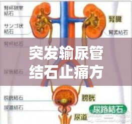 突發輸尿管結石止痛方法：輸尿管結石突發怎么辦 