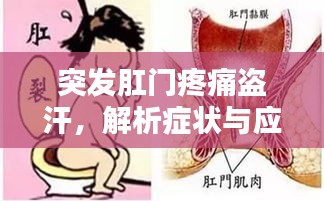 突發肛門疼痛盜汗，解析癥狀與應對良方