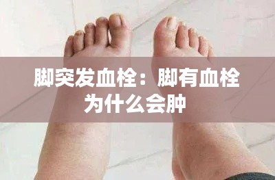 腳突發(fā)血栓：腳有血栓為什么會(huì)腫 