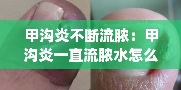 甲溝炎不斷流膿：甲溝炎一直流膿水怎么辦 