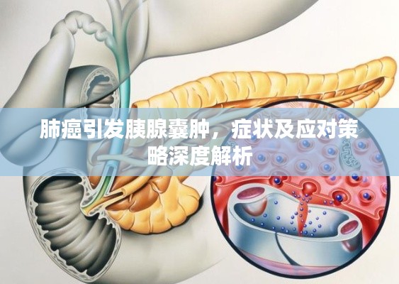 肺癌引發胰腺囊腫，癥狀及應對策略深度解析