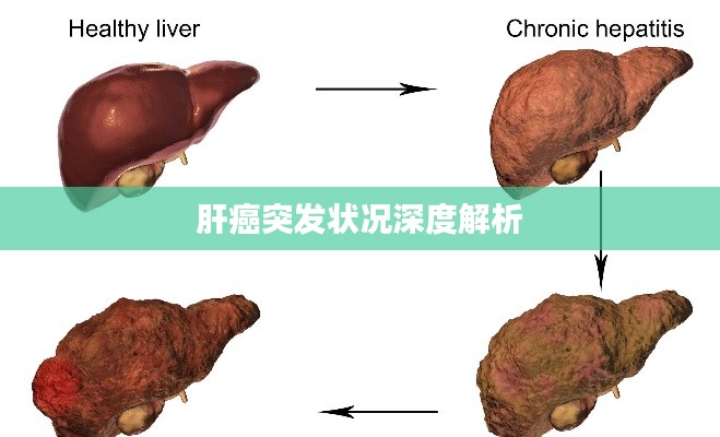 肝癌突發(fā)狀況深度解析