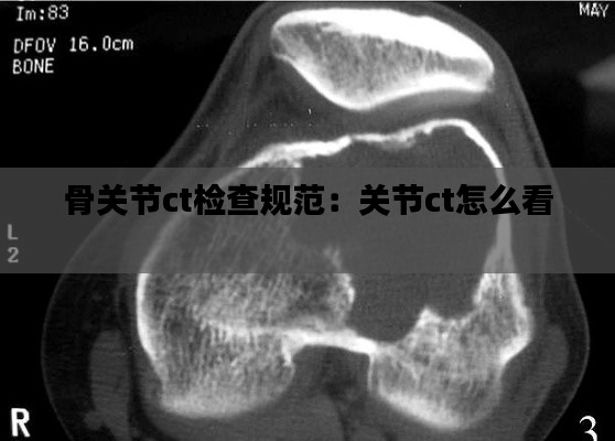 骨關節ct檢查規范：關節ct怎么看 